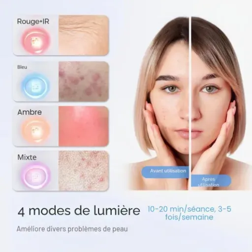 Test Hello Face L6 : le masque LED qui fait le job… si tu es régulier