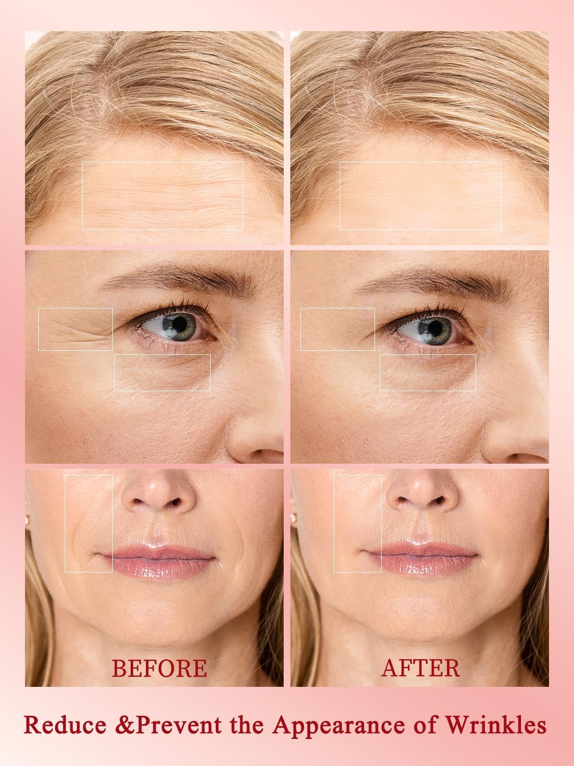 Appareil de raffermissement de la peau à radiofréquence, professionnel 10 W, lifting du visage, réduit les rides, appareil de beauté anti-âge RF sans fil