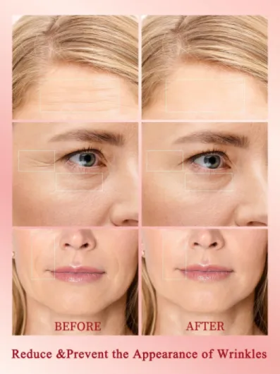 Appareil de raffermissement de la peau à radiofréquence, professionnel 10 W, lifting du visage, réduit les rides, appareil de beauté anti-âge RF sans fil