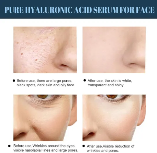 717bo7zCGPL._AC_SL1500_