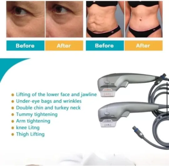 71mgKYvosuL._AC_SL1500_