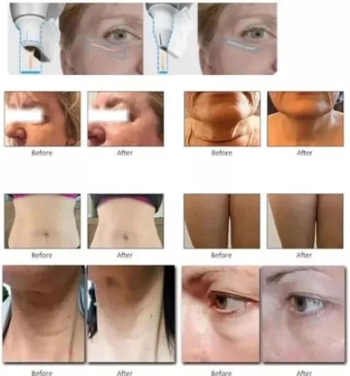 71U4o8UJL9L._AC_SL1500_