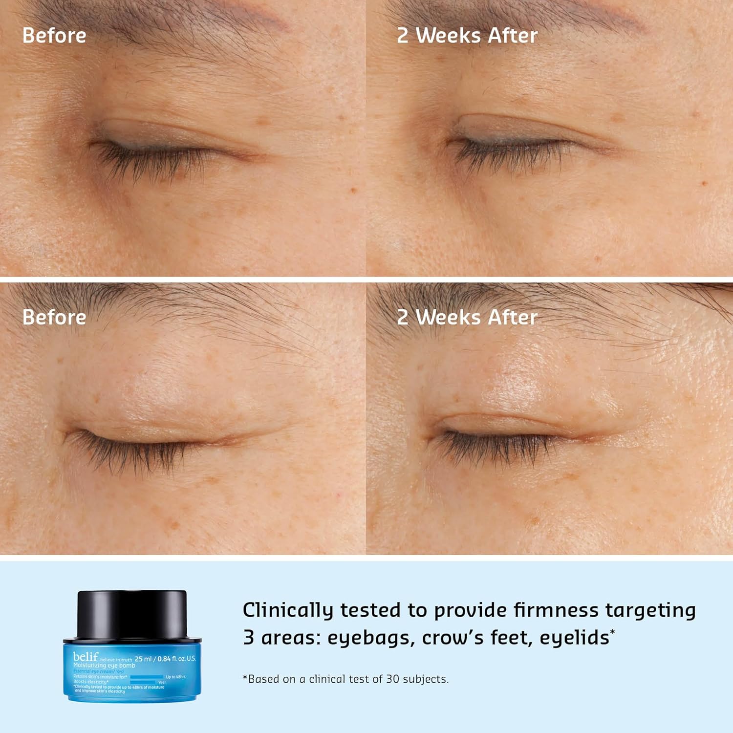 Moisturizing Eye Bomb 25ml, Crème Contour des Yeux, Élasticité Anti-âge, Réduit les Cernes les Rides, Feuille de Consoude Tigergras, Crème Hydratante, Soin des Yeux, Soin de la Peau, Corée Moisturizing Eye Bomb 25 ml (Lot de 1)