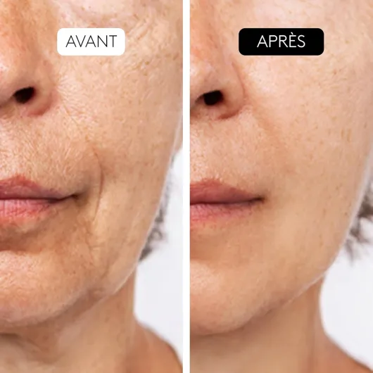 71seYdDzIRL._AC_SL1500_