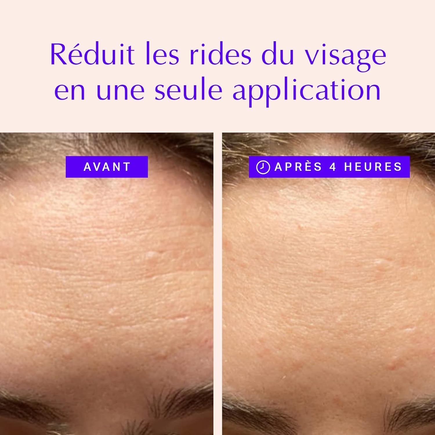 Patchs Anti-rides pour le Visage - Tampons de Soins pour Lisser les Yeux, Bouche et Front - Bande Antirides pour Lifting de Nuit - Réduit Fines Rides et Tonifie Peau - Alternative au Botox (165 pcs) 1 Unité (Lot de 1)