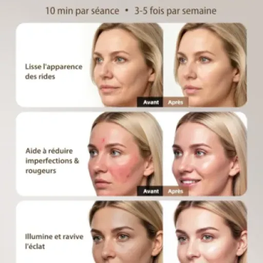 Test XSSNVV NVV03 : le masque LED sans fil qui mise sur le rouge et l’infrarouge
