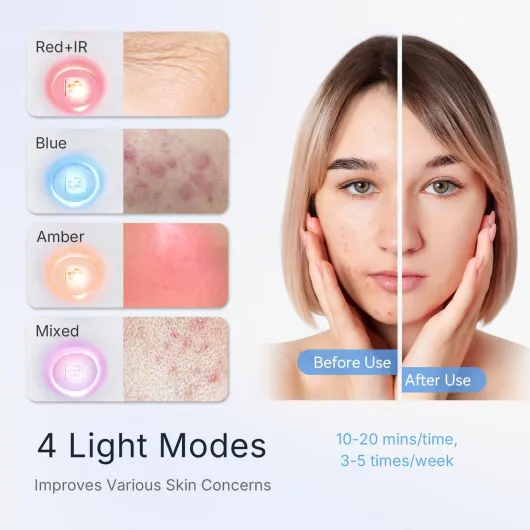 Thérapie par lumière rouge approuvée par la FDA pour le visage, 4 modes, masque de thérapie par lumière photonique, masque de thérapie par lumière rouge proche infrarouge, masque de thérapie par Bleu Brumeux