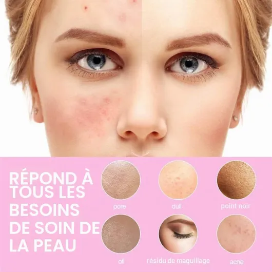 Brosse Nettoyante pour le Visage, Nettoyant Électrique pour le Visage avec 3 TêTes de Brosse Nettoyante pour L'Acné, les Points Noirs, la Peau Morte, le Nettoyage en Profondeur, Rose Couleur Rose