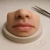 Lifted lip : le lifting de la lèvre supérieure pour rajeunir le sourire